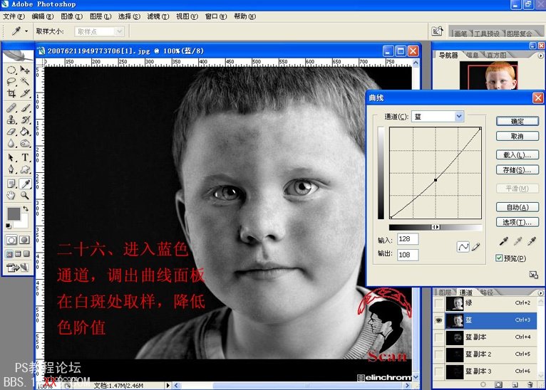 PS磨皮教程:用Photoshop通道去除雀斑