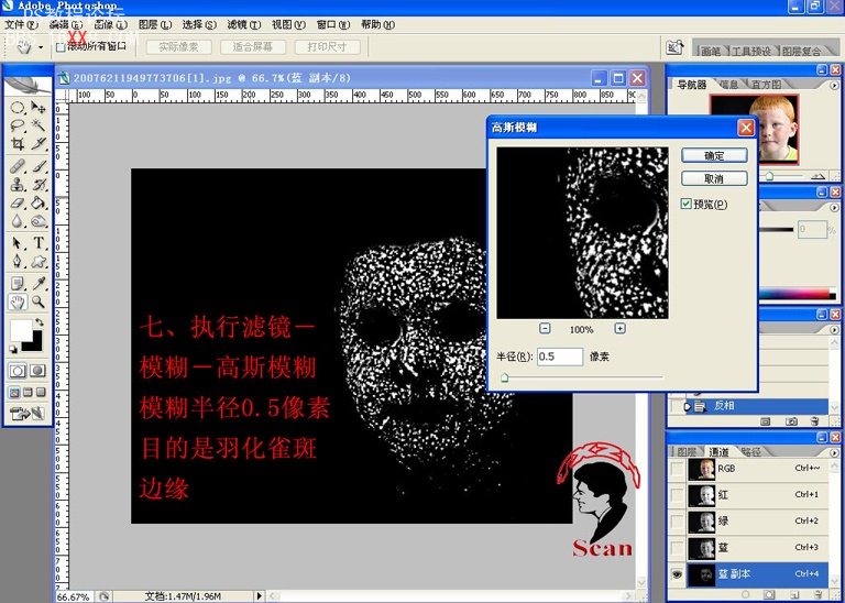 PS磨皮教程:用Photoshop通道去除雀斑