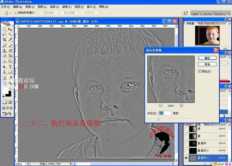 PS磨皮教程:用Photoshop通道去除雀斑