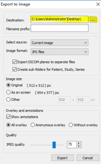 MicroDicom viewer