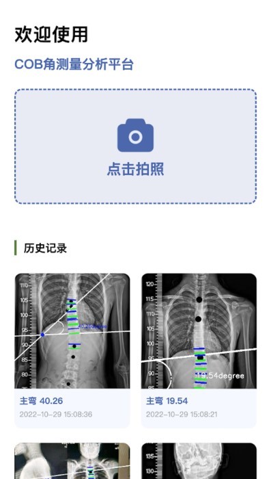 cobb角測量分析平臺app